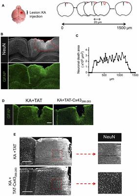 A c-Src Inhibitor Peptide Based on Connexin43 Exerts Neuroprotective Effects through the Inhibition of Glial Hemichannel Activity